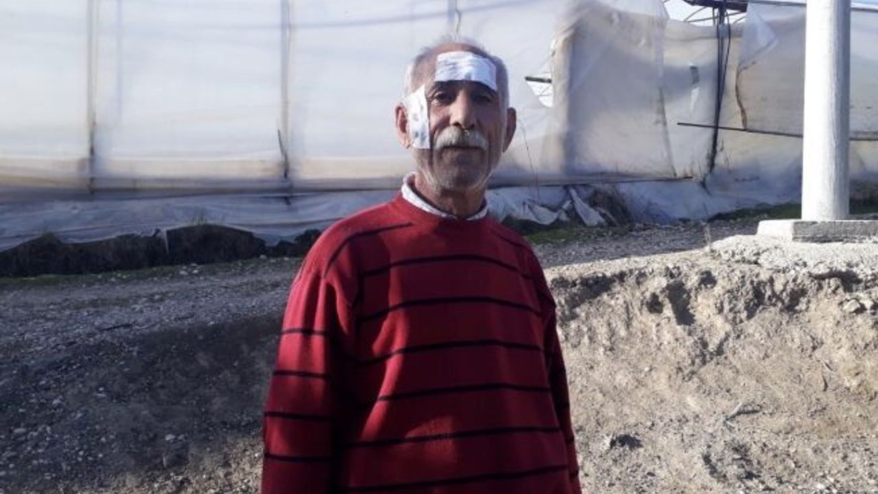 Maganda kurşunuyla başından yaralandı!