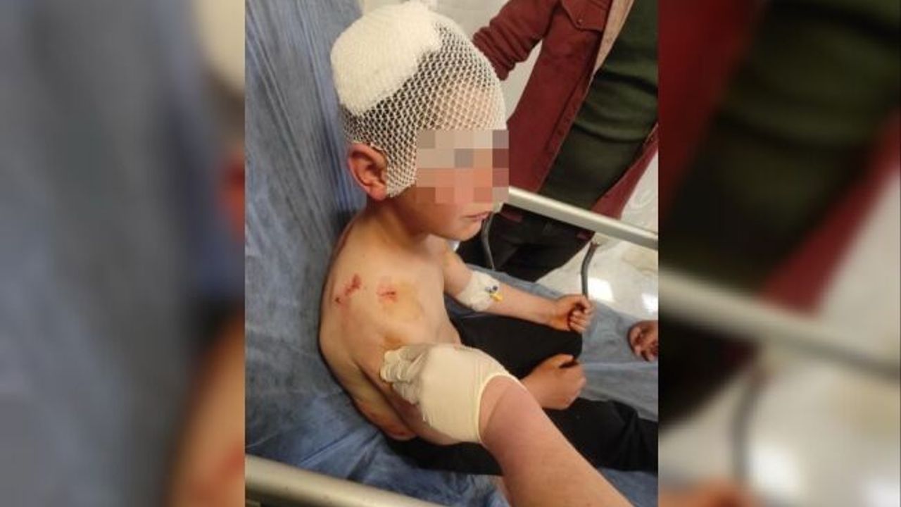 Sokakta oynayan çocuğa başıboş köpek saldırdı