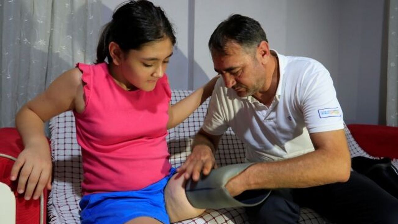  Protez bacağı dar gelen Özge için Türkiye ayağa kalktı!