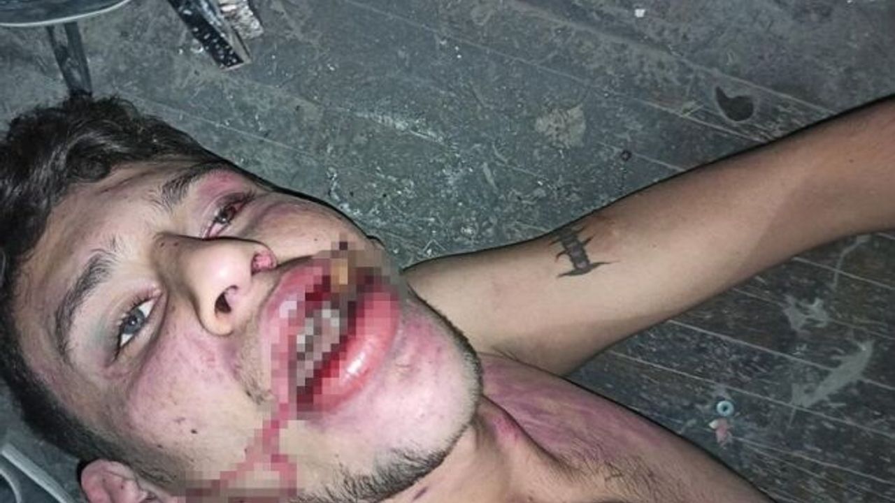 Antalya'da "Böcek yedirip dişlerimi kırdılar" iddiasına 20 yıl hapis talebi