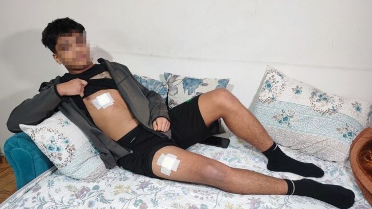 Akran zorbalığı az kalsın öldürüyordu: Önce dövüldü sonra bıçaklandı!