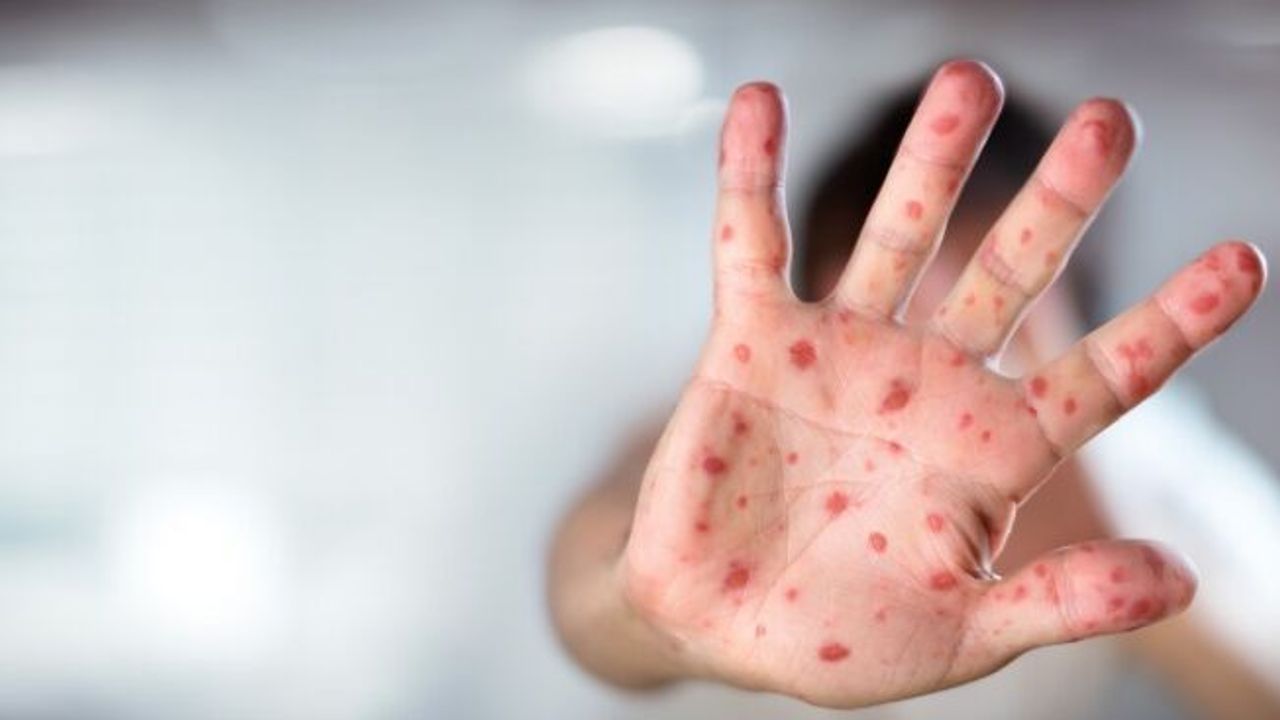 5 yaş altı çocuklar risk altında