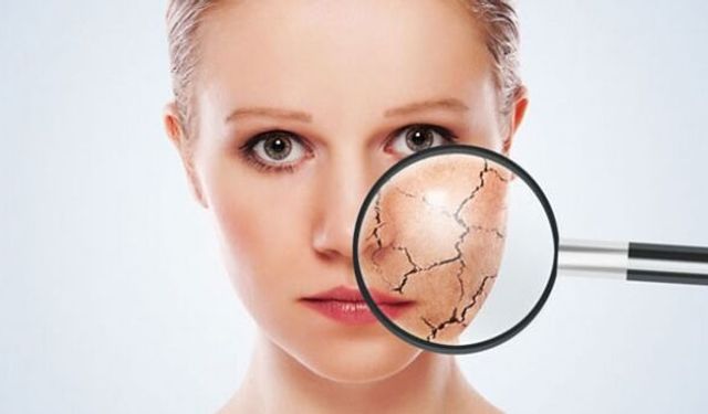 Soğuk hava cildi sessizce yıpratıyor